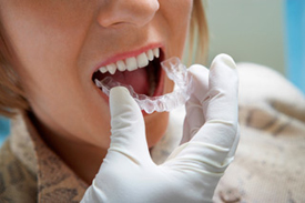 esthetische-tandheelkunde